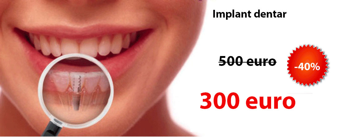 implant dentar ieftin 300 euro