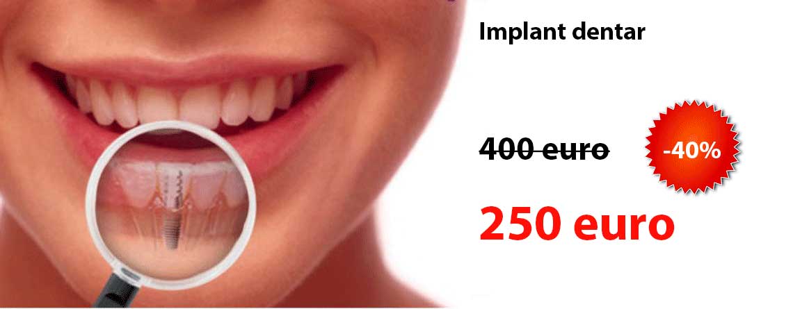 implant dentar pret redus
